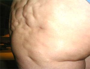 cellu06.jpg cellu06.jpg
