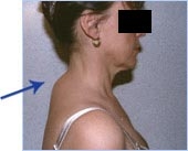 femme1.jpg femme1.jpg
